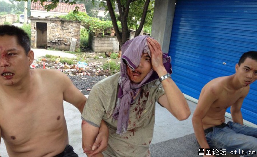 2、图为被打农民工.jpg